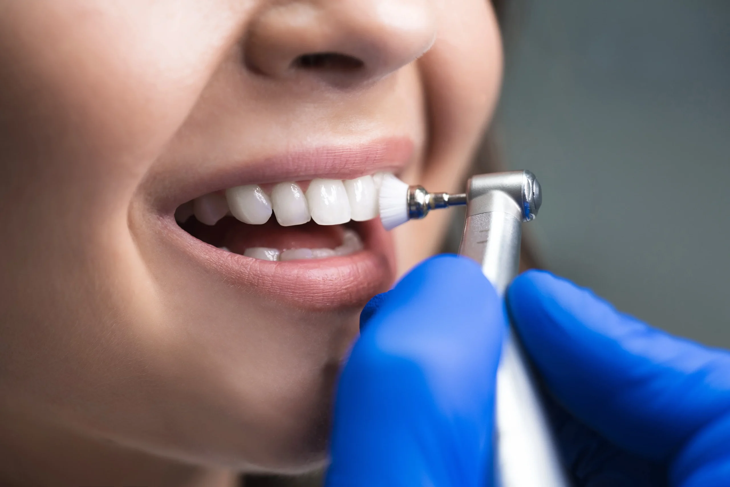 A woman getting her tooth cleaned